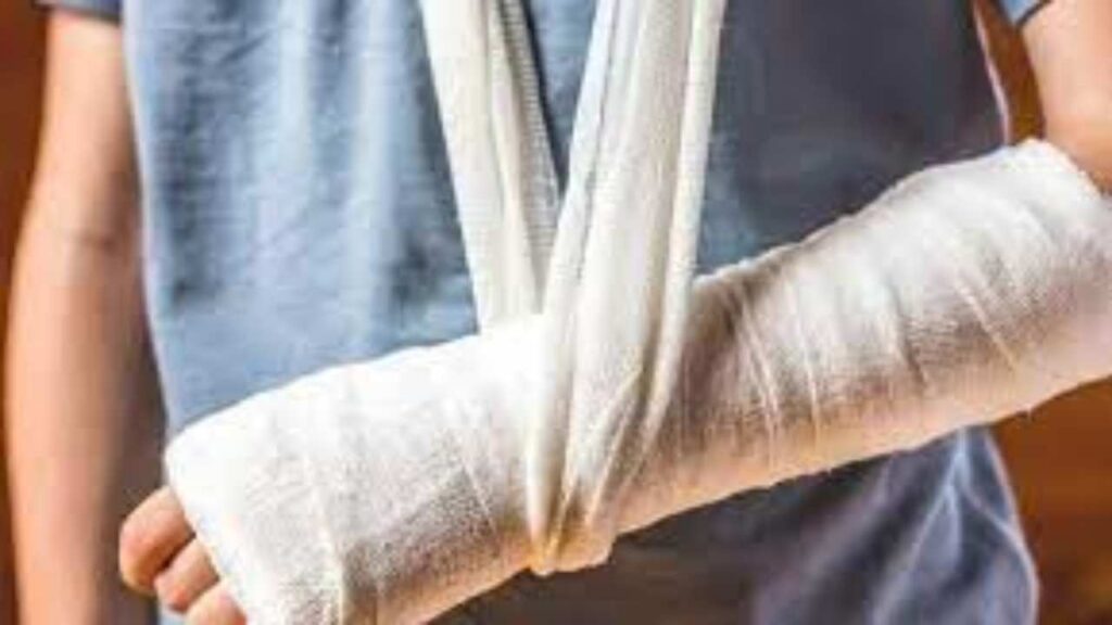 bone fractures
