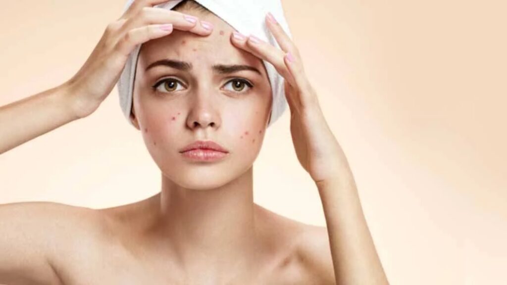 Skin Diseases